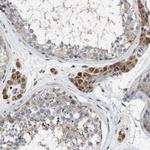 TMEM150A Antibody in Immunohistochemistry (Paraffin) (IHC (P))