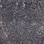 SERTAD2 Antibody in Immunohistochemistry (IHC)