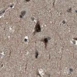 SERTAD2 Antibody in Immunohistochemistry (IHC)