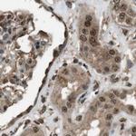 SERTAD2 Antibody in Immunohistochemistry (IHC)