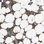 SERTAD2 Polyclonal Antibody