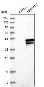 SERTAD2 Antibody in Western Blot (WB)