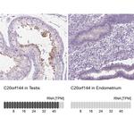 C20orf144 Antibody in Immunohistochemistry (IHC)