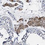 MOV10L1 Polyclonal Antibody