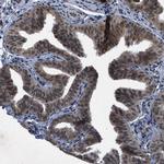 ZNHIT1 Antibody in Immunohistochemistry (IHC)