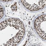ZNHIT1 Antibody in Immunohistochemistry (IHC)