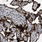 ZNHIT1 Antibody in Immunohistochemistry (IHC)