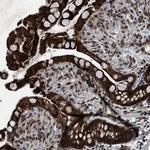 ZNHIT1 Antibody in Immunohistochemistry (IHC)