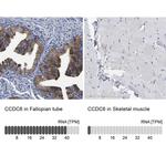 CCDC6 Antibody in Immunohistochemistry (IHC)