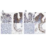 CCDC6 Polyclonal Antibody