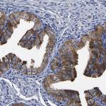 CCDC6 Antibody in Immunohistochemistry (IHC)