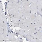 CCDC6 Antibody in Immunohistochemistry (IHC)