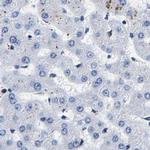 CCDC6 Antibody in Immunohistochemistry (IHC)