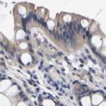 CCDC6 Antibody in Immunohistochemistry (IHC)