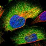 CCDC6 Polyclonal Antibody