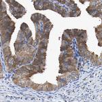 CCDC6 Antibody in Immunohistochemistry (Paraffin) (IHC (P))