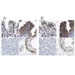 CCDC6 Antibody in Immunohistochemistry (IHC)