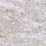 CCDC6 Antibody in Immunohistochemistry (IHC)