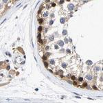 CCDC6 Antibody in Immunohistochemistry (IHC)