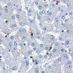 CCDC6 Antibody in Immunohistochemistry (IHC)