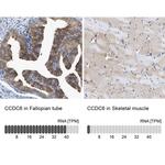 CCDC6 Antibody