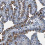 C21orf59 Antibody in Immunohistochemistry (Paraffin) (IHC (P))