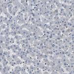 RBM28 Antibody in Immunohistochemistry (Paraffin) (IHC (P))
