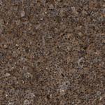 RBM28 Antibody in Immunohistochemistry (Paraffin) (IHC (P))