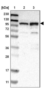 RBM28 Antibody in Western Blot (WB)