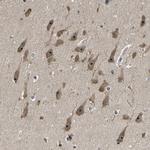 RBM28 Antibody in Immunohistochemistry (IHC)