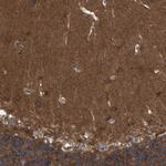 RAP1GDS1 Antibody in Immunohistochemistry (Paraffin) (IHC (P))