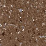 RAP1GDS1 Antibody in Immunohistochemistry (Paraffin) (IHC (P))