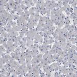 RAP1GDS1 Antibody in Immunohistochemistry (Paraffin) (IHC (P))