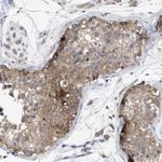 RAP1GDS1 Antibody in Immunohistochemistry (Paraffin) (IHC (P))