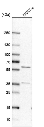 RAP1GDS1 Antibody in Western Blot (WB)