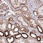 NEK3 Antibody in Immunohistochemistry (IHC)