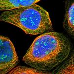 TWISTNB Polyclonal Antibody