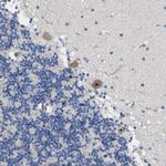 TWISTNB Antibody in Immunohistochemistry (IHC)