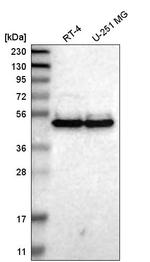 TWISTNB Antibody in Western Blot (WB)