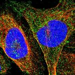 Prostein Polyclonal Antibody