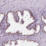 Prostein Antibody in Immunohistochemistry (Paraffin) (IHC (P))