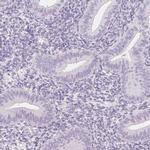 Prostein Antibody in Immunohistochemistry (IHC)