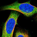 DLEC1 Polyclonal Antibody