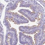 DLEC1 Antibody in Immunohistochemistry (Paraffin) (IHC (P))