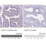 DLEC1 Antibody in Immunohistochemistry (IHC)