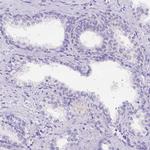 DLEC1 Antibody in Immunohistochemistry (IHC)