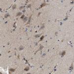 PDP1 Antibody in Immunohistochemistry (Paraffin) (IHC (P))