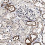 PDP1 Antibody in Immunohistochemistry (Paraffin) (IHC (P))