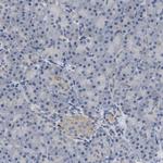 PDP1 Antibody in Immunohistochemistry (Paraffin) (IHC (P))