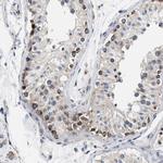 PDP1 Polyclonal Antibody